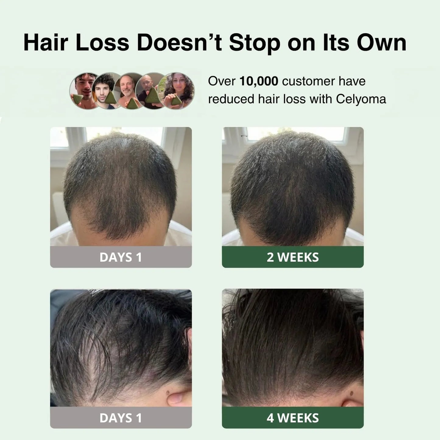 Celyoma Hair Growth and Strengthening Soap®